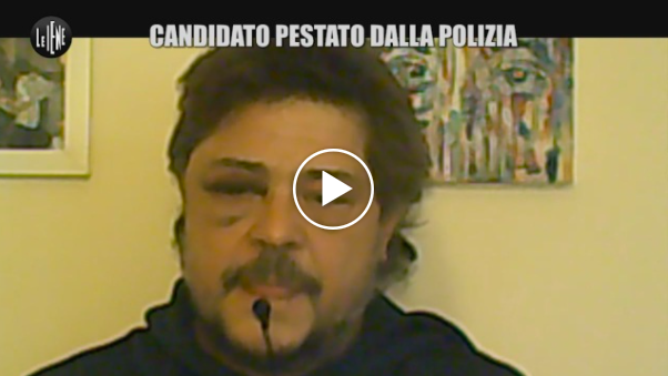 Candidato Picchiato Polizia VIDEO