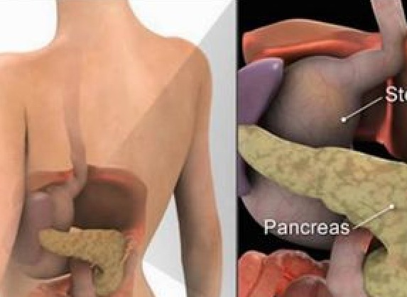 infusi tisane pancreas ricetta
