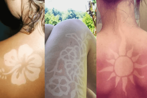 sunburn_tattoo_2019